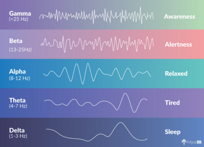 Brain waves e1713107767256