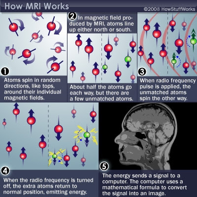 MRI